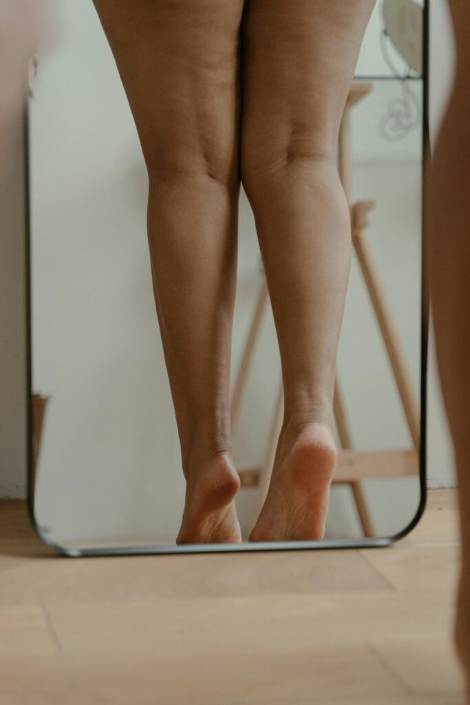cellulite